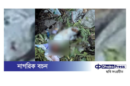 মোহাম্মদপুরে ডাস্টবিনে মানুষের খণ্ডিত পা উদ্ধার