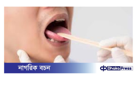 জিব দেখে স্বাস্থ্যের অবস্থা বোঝার উপায়