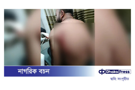 শহীদ মিনারে বিএনপির দুই পক্ষের সংঘর্ষে আহত ২