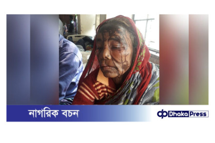 কুড়িগ্রামে বৃদ্ধাকে এসিড নিক্ষেপ, মামলা নেয়নি পুলিশ 