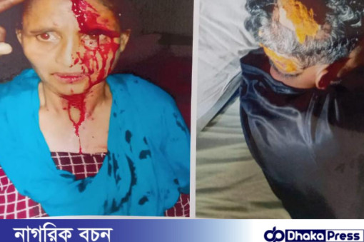 মাদারগঞ্জে  ছিনতাই-বিদেশি চাইনিজ  কুড়াল  দিয়ে মাথায় আঘাত।