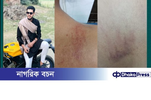রাজারগাঁওয়ে যাত্রী ওঠানোকে কেন্দ্র করে রক্তক্ষয়ী হামলা, গুরুতর আহত যুবক