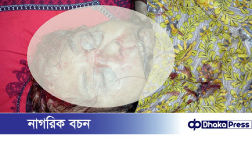 বড়াইগ্রামে বৃদ্ধাকে মুখমণ্ডল থেতলে হত্যা করেছে দুর্বৃত্তরা