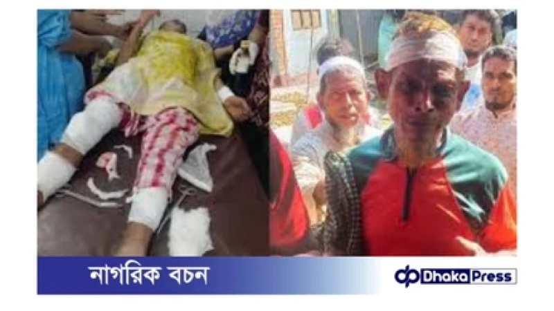 নারায়ণগঞ্জে আ. লীগ-বিএনপি সংঘর্ষ: আহত ১৫