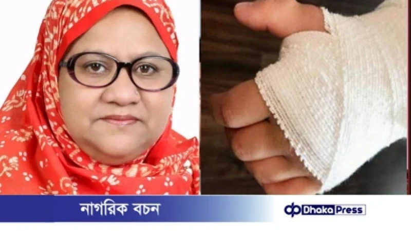 মুরাদনগরে উপজেলা মহিলা দলের সভাপতির ওপর পরিকল্পিত হামলার অভিযোগ