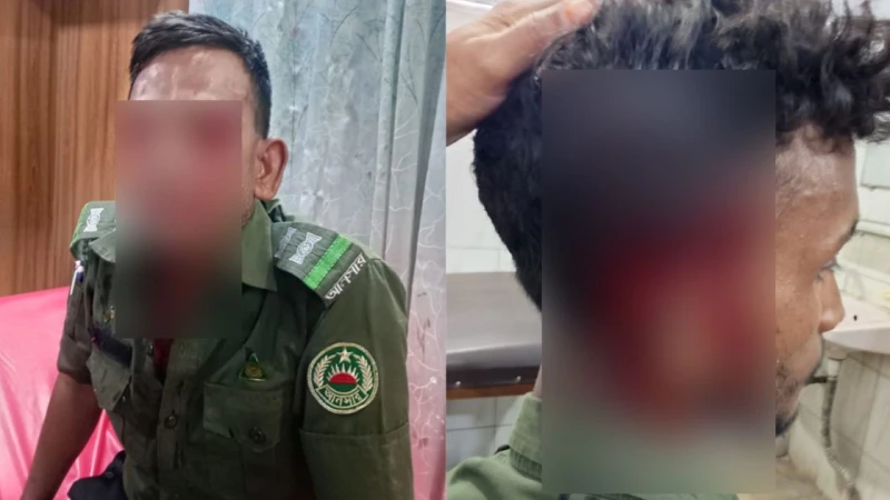 সাভারে হকারদের হামলায় চোখ থেঁতলে গেল আনসার সদস্যের