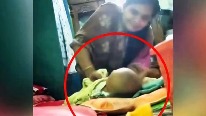 নরসিংদীতে দুই মাসের শিশুর পা ভেঙে দেওয়ার অভিযোগ, অভিযুক্ত আপন চাচি
