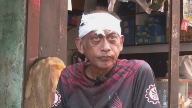 যশোরে অভিনেতা সমু চৌধুরীর মাথা ফাটালেন গ্যারেজ মালিক ও মেকানিক
