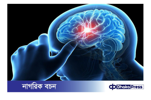 স্ট্রোক হওয়ার কারণ ও লক্ষণ